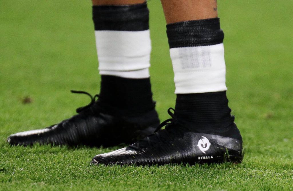 Quali giocatori indossano scarpe da calcio nere e perchè?
